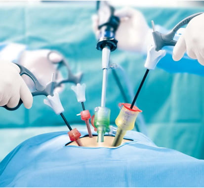 general-and-laparoscopic-surgery